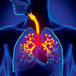 Acute infections